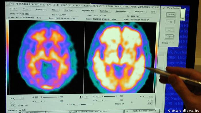 Medico a confronto le immagini cerebrali digitali alla clinica universitaria di Lipsia