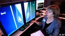تست تشخیص سرطان سینه در درمان زودهنگام بیماری در زنان موثر است