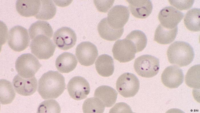 Blutausstrich mit Malariaerregern
(Foto: Bernhard-Nocht-Institut).
