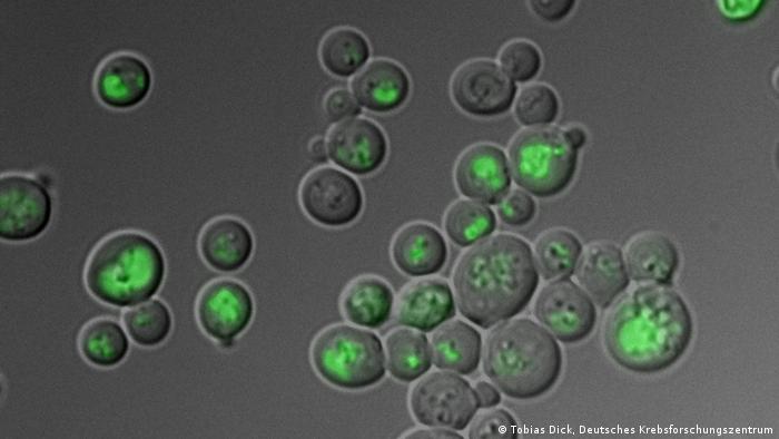 Bildüberschrift: DKFZ Biosensor auf oxidiertem Glutathion<br /><br /><br /><br />
Bildbeschreibung:<br /><br /><br /><br />
Mit einem neuen Biosensor versuchen Forscher am Deutschen Krebsforschungszentrum in Heidelberg dem oxidierten Glutathion auf die Spur zu kommen: Glutathion ist ein Stoff, den die Zellen produzieren und der Oxidantien, die in Zellen eindringen bindet und in Sicherheitsbereichen wegsperrt. Die Vakuolen der Hefezellen leuchten grün. (Foto: © Tobias Dick, Deutsches Krebsforschungszentrum)<br /><br /><br /><br />
Die Pressestelle des Deutschen Krebsforschungszentrum DKFZ in Heidelberg hat mir dieses Bild zur Veröffentlichung auf www.dw.de zur Verfügung gestellt. Zulieferer: Fabian Schmidt/DW.<br /><br /><br /><br />
