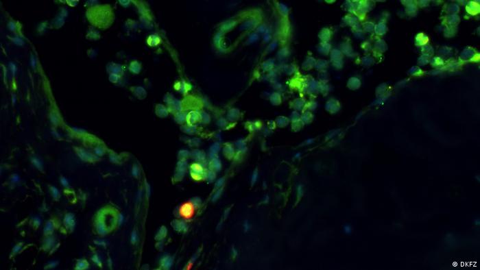 خلايا جذعية سرطانية في نخاع عظم حيوان الفأر: دون بيئة محيطة ملائمة تفقد الخلايا السرطانية خطورتها.