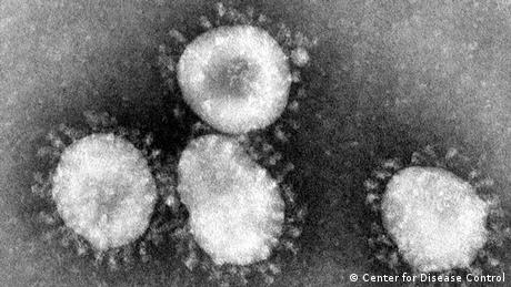 أقل من نصف المصابين بفيروس كورونا نقلوا العدوى إلى ذويهم   عالم المنوعات   DW.DE   28.08.2014