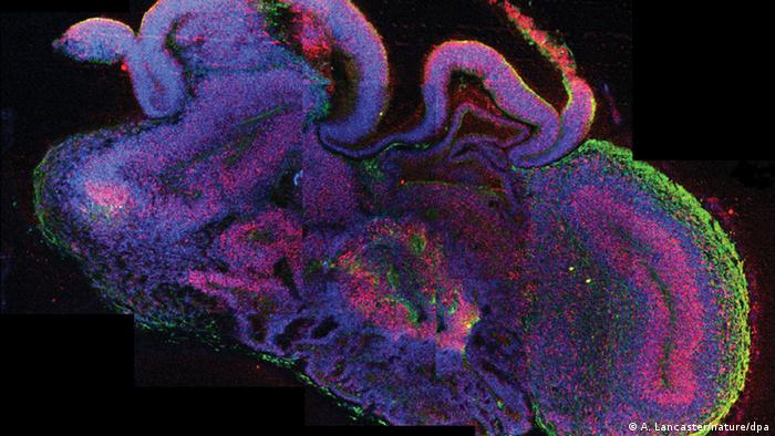 Ilmuwan Tumbuhkan Jaringan Otak dari Sel Punca