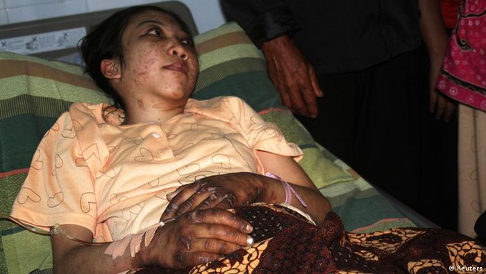 Erwiana Sulistyaningsih in bed with injuries 