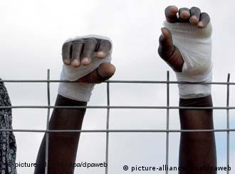 The injured hands of an African immigrant raised above the fence 