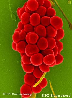 Magnified Staphylococcus aureus (Photo: Helmholtz-Zentrum für Infektionsforschung, Braunschweig)